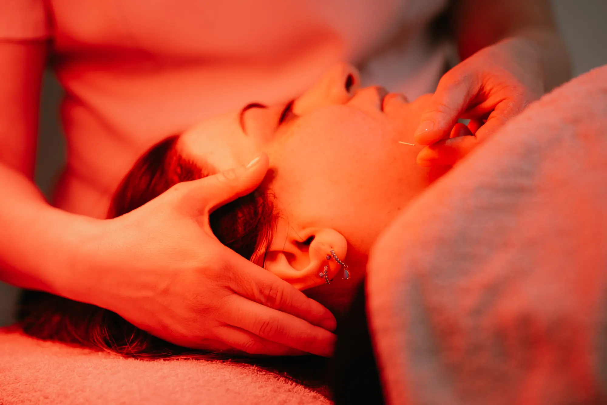 Cosmetische Acupunctuur